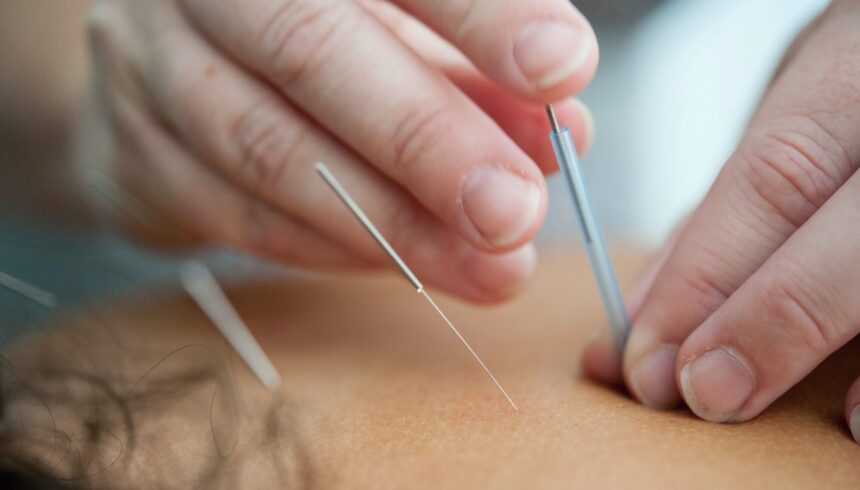 Acupuncture for refugee friends: “The positive effect was immediate. I didn’t expect it myself’!’